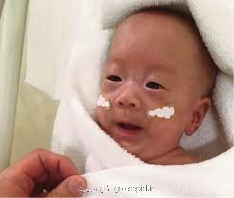 نوزاد مینیاتوری ژاپنی در سلامت كامل