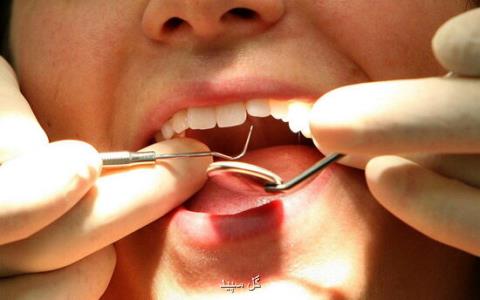 نكات مهم برای سلامت دهان و دندان